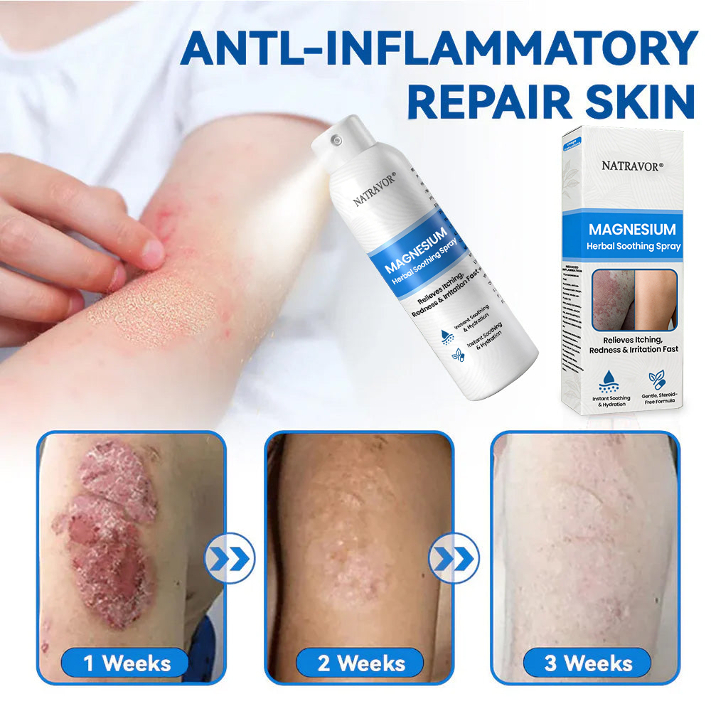 🔥 Natravor® Magnesium Spray – Fast Relief for Itchy, Red & Sensitive Skin (Even Intimate Areas)