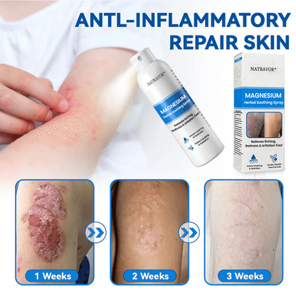 🔥 Natravor® Magnesium Spray – Fast Relief for Itchy, Red & Sensitive Skin (Even Intimate Areas)