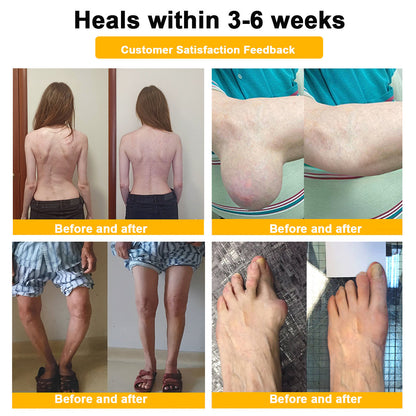 🎁Flash Sale - Natravor® Botulinum Toxin & Bee Venom Pain-Relief Bone Healing Cream🐝💎