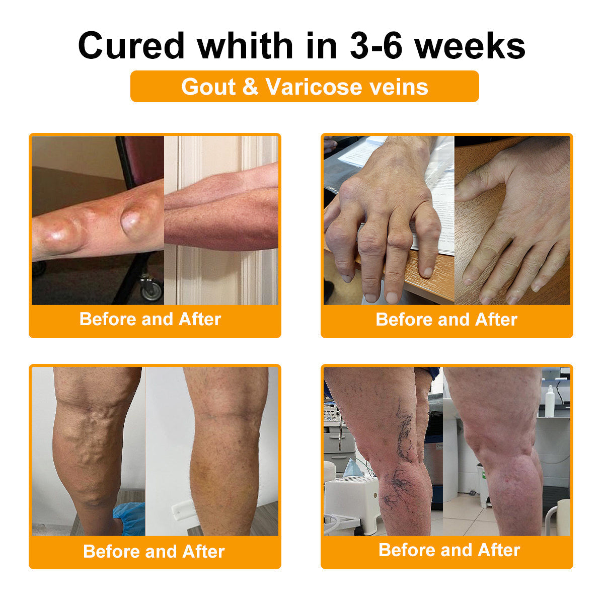 🎁Flash Sale - Natravor® Botulinum Toxin & Bee Venom Pain-Relief Bone Healing Cream🐝💎