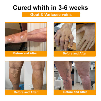 🎁Flash Sale - Natravor® Botulinum Toxin & Bee Venom Pain-Relief Bone Healing Cream🐝💎