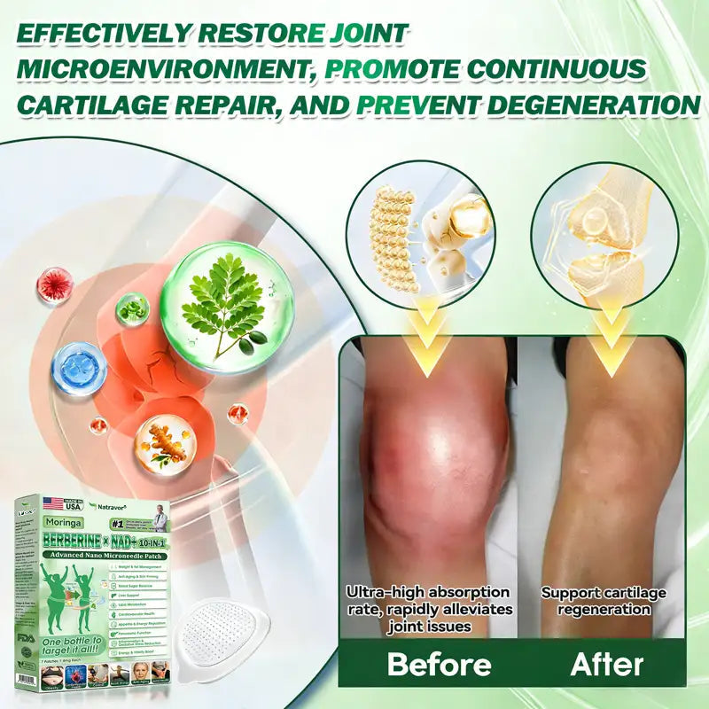 𝐎𝐟𝐟𝐢𝐜𝐢𝐚𝐥 𝐔𝐒 𝐒𝐭𝐨𝐫𝐞 | 🧑‍⚕️🩺 Natravor® Moringa · Berberine × NAD+ 𝟏𝟎-𝐢𝐧-𝟏 𝐀𝐝𝐯𝐚𝐧𝐜𝐞𝐝 𝐍𝐚𝐧𝐨 𝐌𝐢𝐜𝐫𝐨𝐧𝐞𝐞𝐝𝐥𝐞 𝐏𝐚𝐭𝐜𝐡 — 𝐎𝐧𝐜𝐞 𝐃𝐚𝐢𝐥𝐲, 𝐕𝐢𝐬𝐢𝐛𝐥𝐞 𝐑𝐞𝐬𝐮𝐥𝐭𝐬 𝐢𝐧 𝟕 𝐃𝐚𝐲𝐬