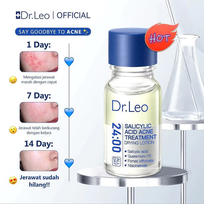 Salicylic Acid Acne Treatment Drying Lotion