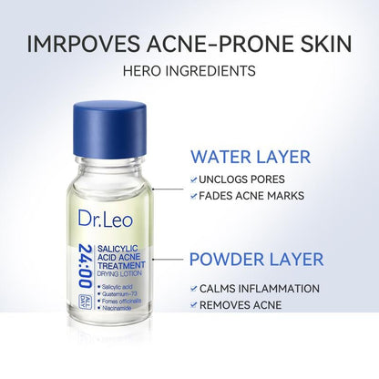 Salicylic Acid Acne Treatment Drying Lotion